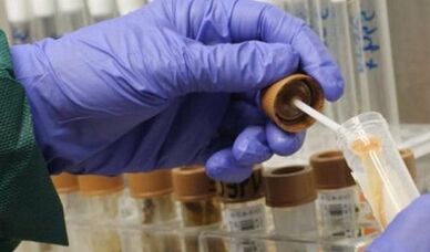 Die Notwendigkeit, die Parasitenanalyse zu bestehen