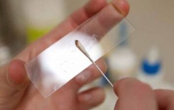 Welche Beweise sollten für Parasiten erfasst werden