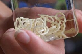 Parasiten des menschlichen Körpers