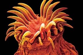 Trematodenparasiten beim Menschen