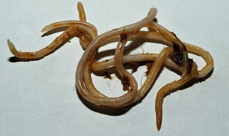 Toxocara des menschlichen Körpers