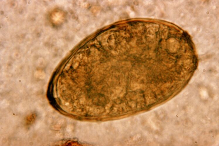 menschlicher Lungenegel